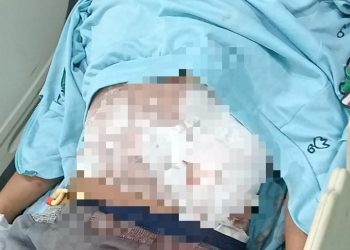 Buruh Harian di Bengkulu Jadi Korban Begal, Alami Luka Tusuk hingga Usus Terburai