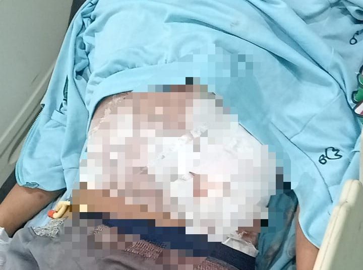 Buruh Harian di Bengkulu Jadi Korban Begal, Alami Luka Tusuk hingga Usus Terburai