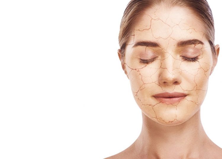 Ketahui Faktor Penyebab Kulit Kering, Salah Satunya Kurang Minum