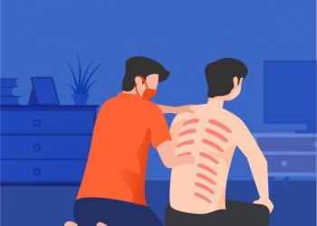 Inilah Manfaat Kerokan: Tradisi “Menggores” untuk Meredakan Masuk Angin