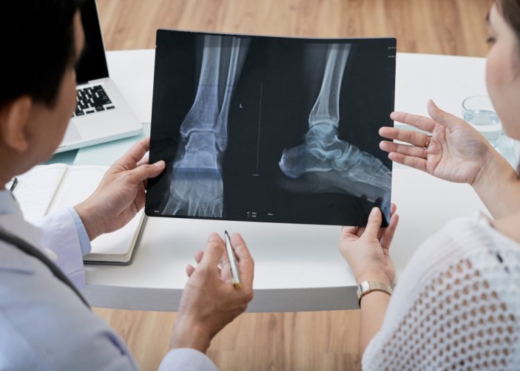 Penting Diketahui, Ini Dia 7 Kebiasaan Buruk yang Dapat Melemahkan Tulang