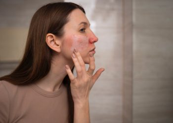 Coba 4 Cara Ini Untuk Atasi Kulit yang Bersisik