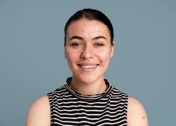 Ini 5 Kebiasaan Buruk yang Dapat Merusak Kulit Wajah